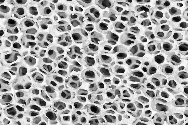 ceramic-filter ceramic filter
